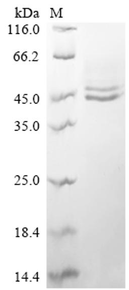 (Tris-Glycine gel) Discontinuous SDS-PAGE (reduced) with 5% enrichment gel and 15% separation gel.