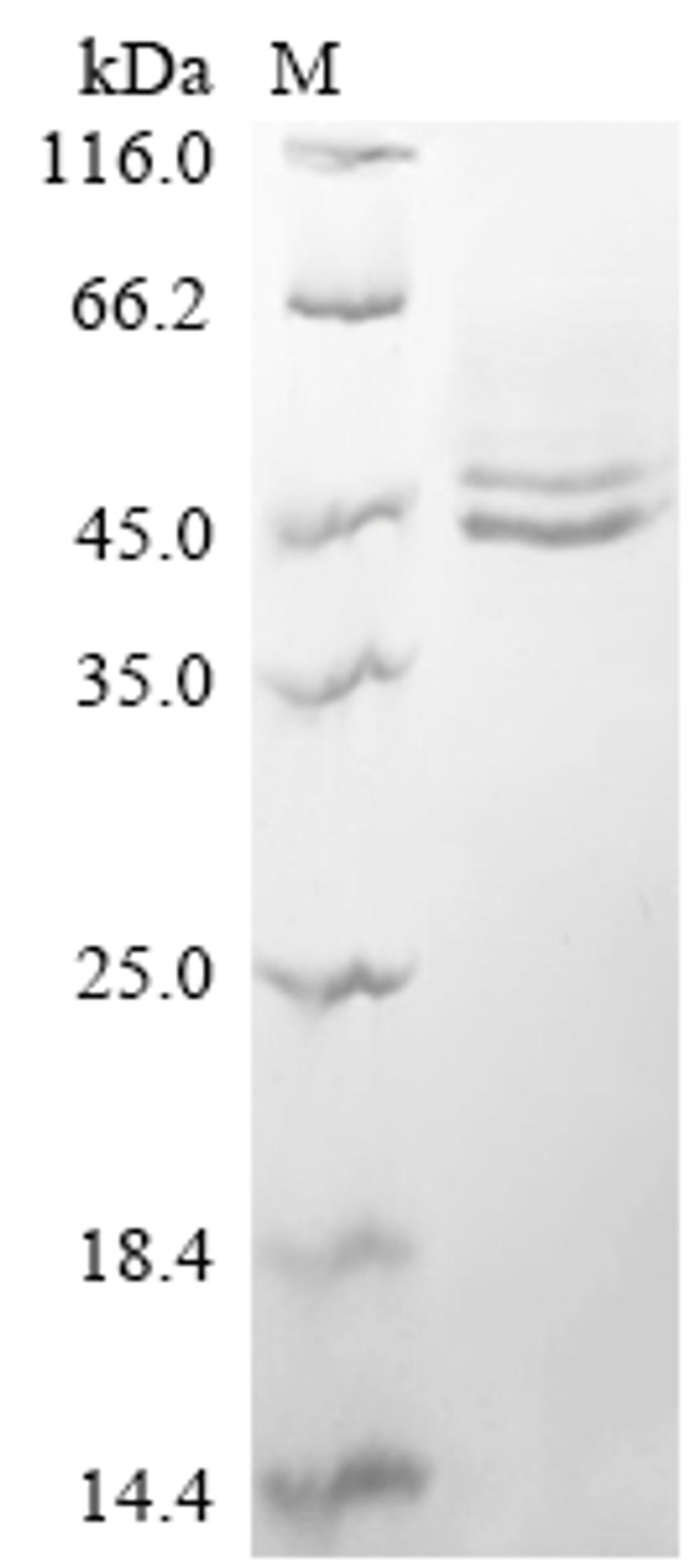 (Tris-Glycine gel) Discontinuous SDS-PAGE (reduced) with 5% enrichment gel and 15% separation gel.