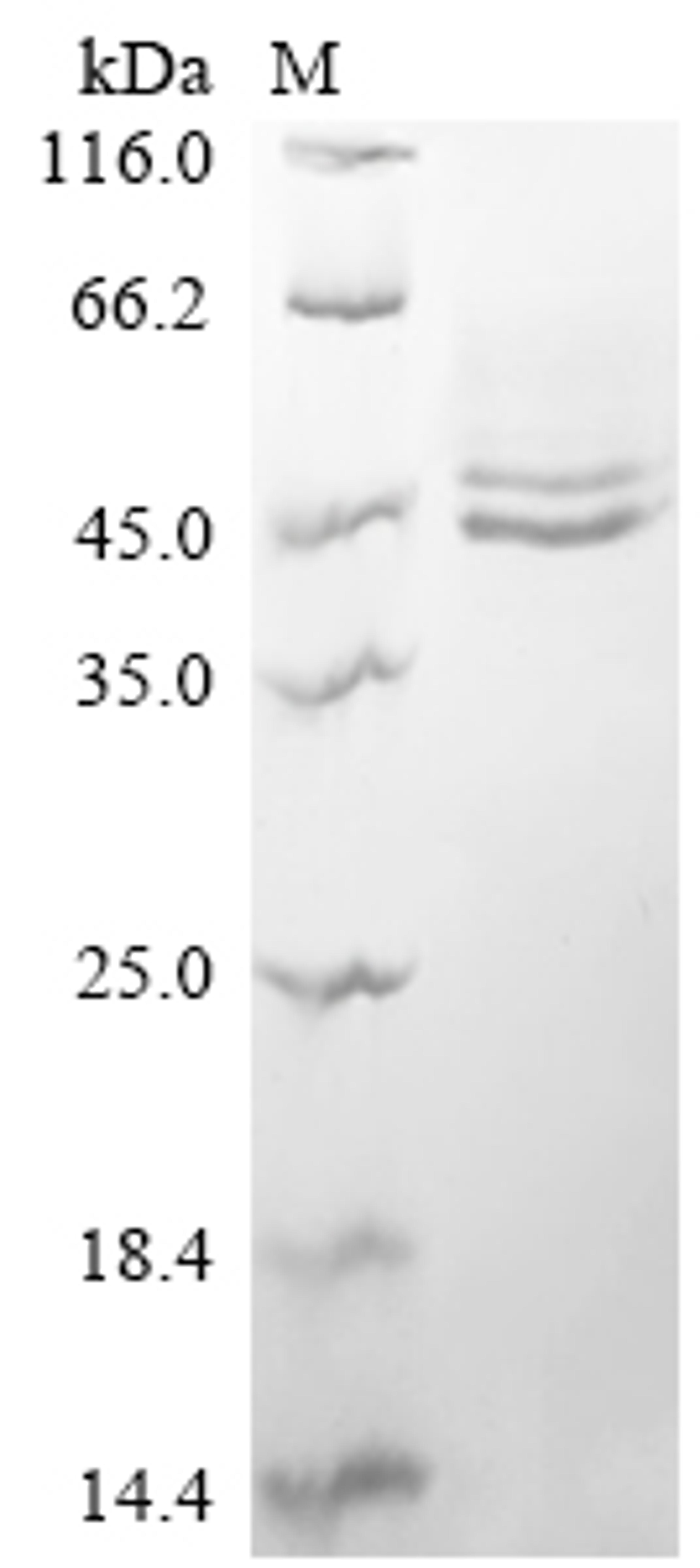 (Tris-Glycine gel) Discontinuous SDS-PAGE (reduced) with 5% enrichment gel and 15% separation gel.