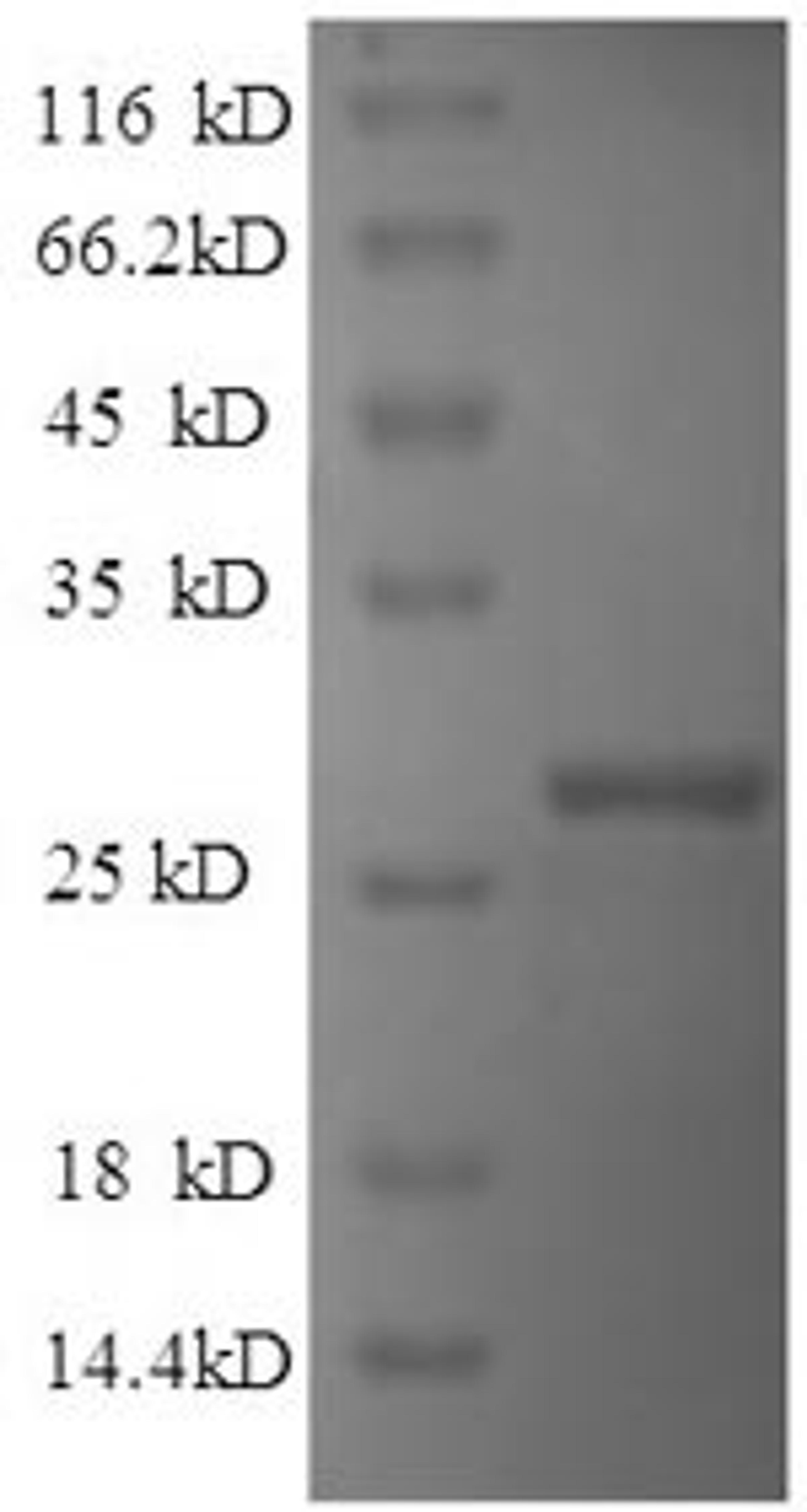 (Tris-Glycine gel) Discontinuous SDS-PAGE (reduced) with 5% enrichment gel and 15% separation gel.