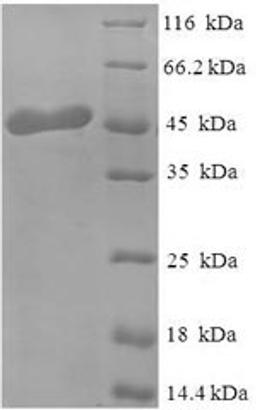 (Tris-Glycine gel) Discontinuous SDS-PAGE (reduced) with 5% enrichment gel and 15% separation gel.