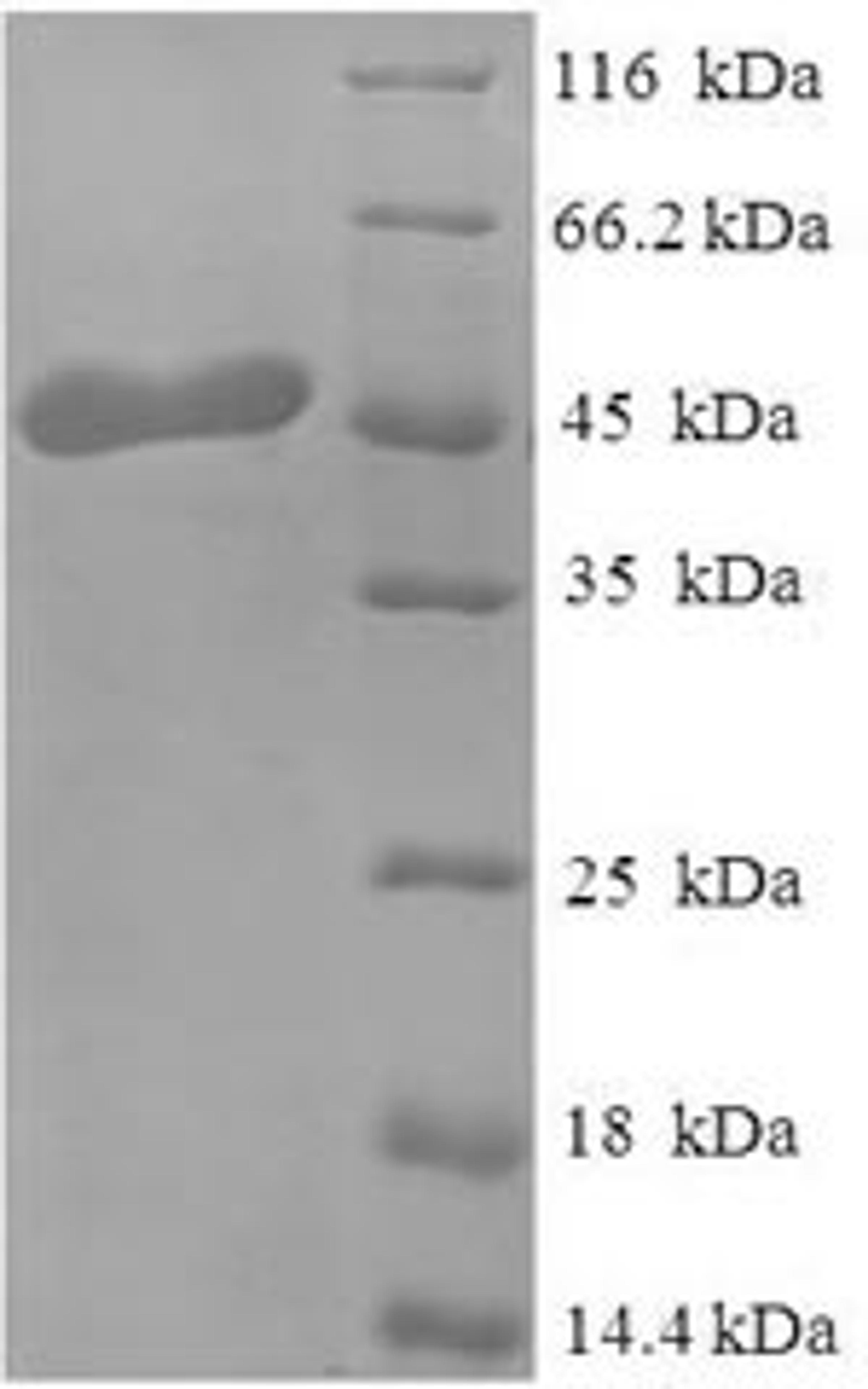 (Tris-Glycine gel) Discontinuous SDS-PAGE (reduced) with 5% enrichment gel and 15% separation gel.