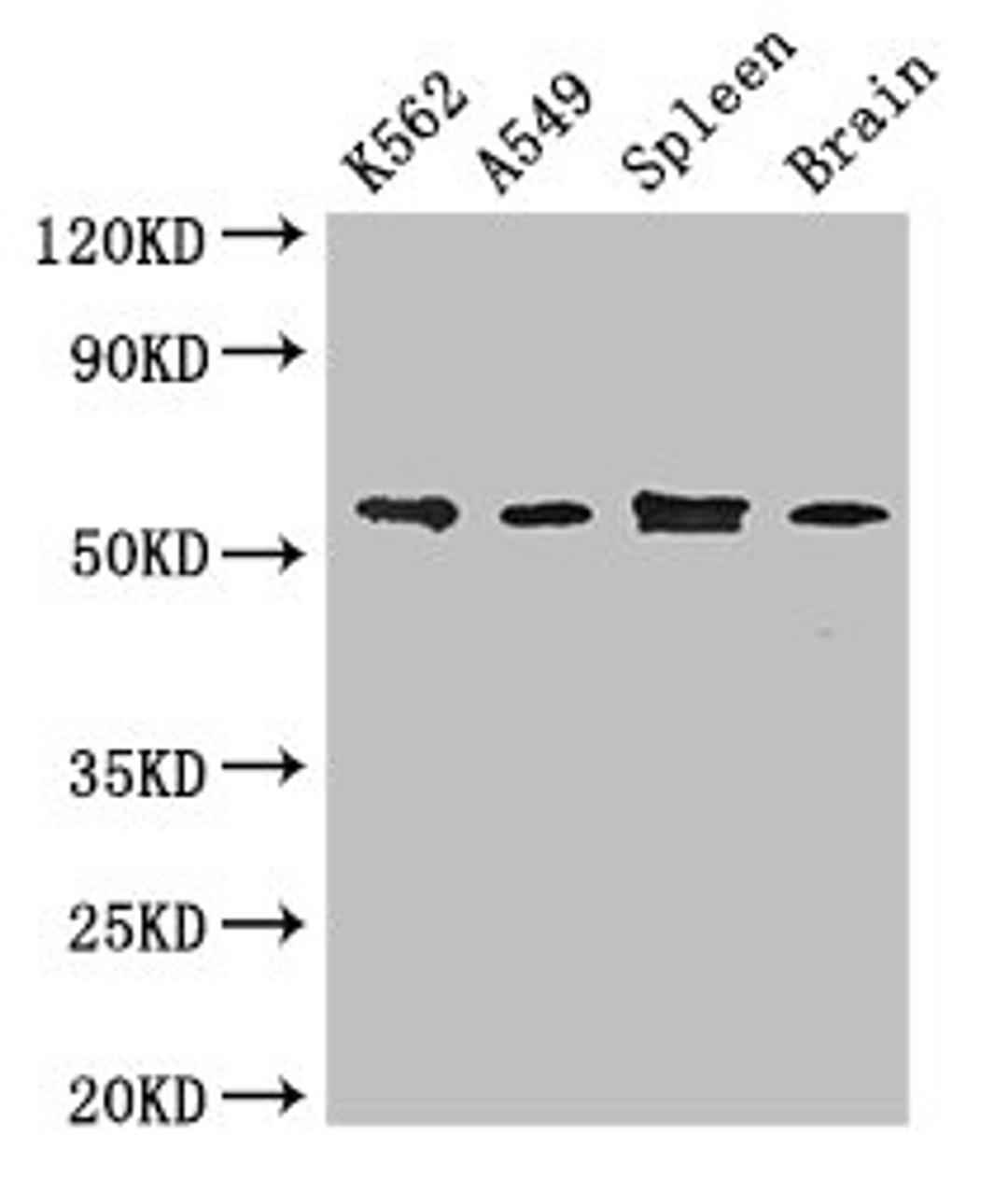 Western Blot. Positive WB detected in: K562 whole cell lysate, A549 whole cell lysate, Mouse spleen tissue, Mouse brain tissue. All lanes: CORO1C antibody at 3.4ug/ml. Secondary. Goat polyclonal to rabbit IgG at 1/50000 dilution. Predicted band size: 54, 55, 59 kDa. Observed band size: 54 kDa. 