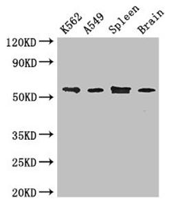 Western Blot. Positive WB detected in: K562 whole cell lysate, A549 whole cell lysate, Mouse spleen tissue, Mouse brain tissue. All lanes: CORO1C antibody at 3.4ug/ml. Secondary. Goat polyclonal to rabbit IgG at 1/50000 dilution. Predicted band size: 54, 55, 59 kDa. Observed band size: 54 kDa. 