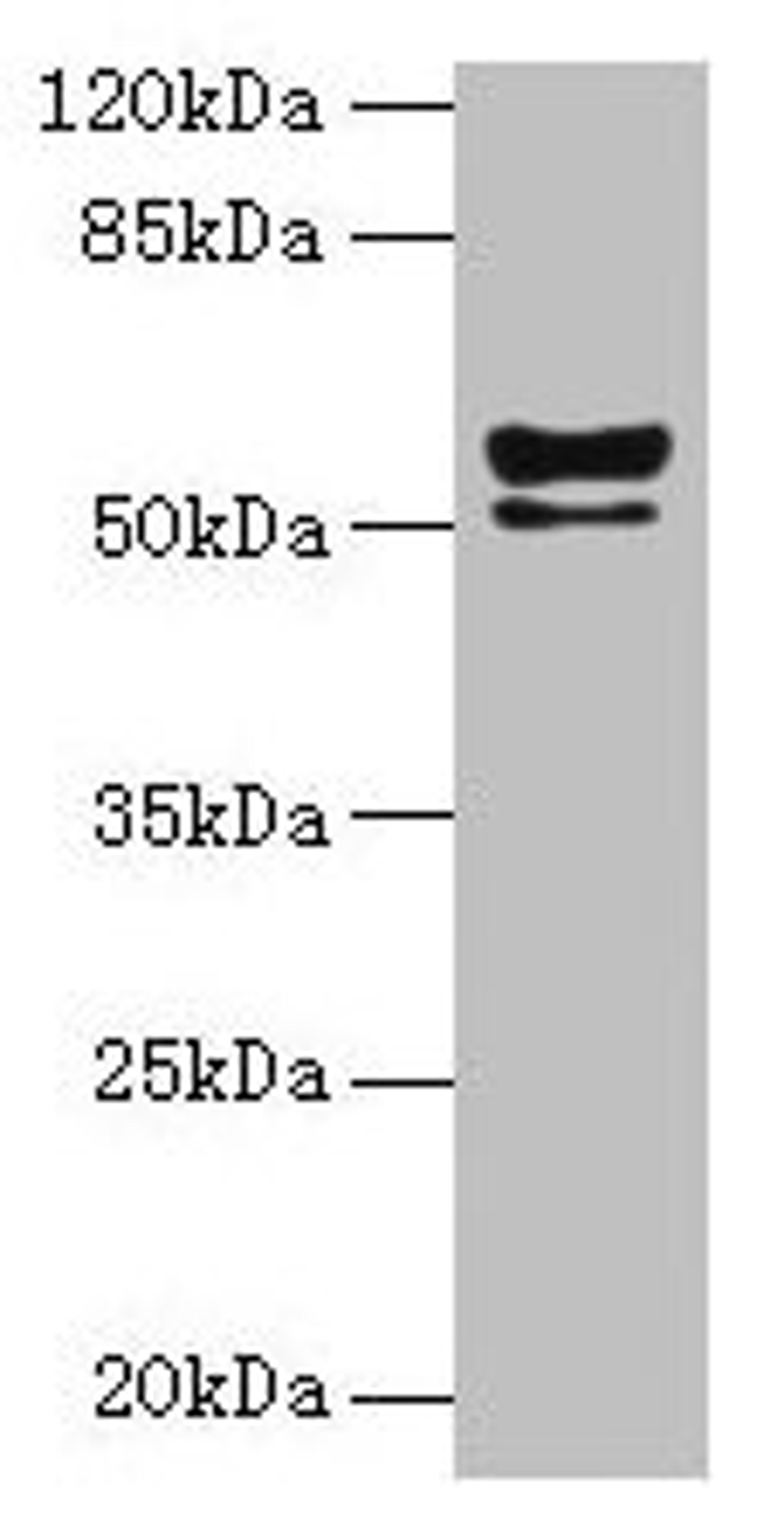 Western blot. All lanes: KRT72 antibody at 2µg/ml + MCF-7 whole cell lysate. Secondary. Goat polyclonal to rabbit IgG at 1/10000 dilution. Predicted band size: 56, 52 kDa. Observed band size: 56, 52 kDa