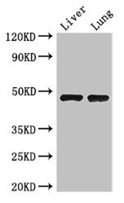 Western Blot. Positive WB detected in: Mouse liver tissue, Mouse lung tissue. All lanes: SEC14L3 antibody at 3ug/ml. Secondary. Goat polyclonal to rabbit IgG at 1/50000 dilution. Predicted band size: 47 kDa. Observed band size: 47 kDa. 