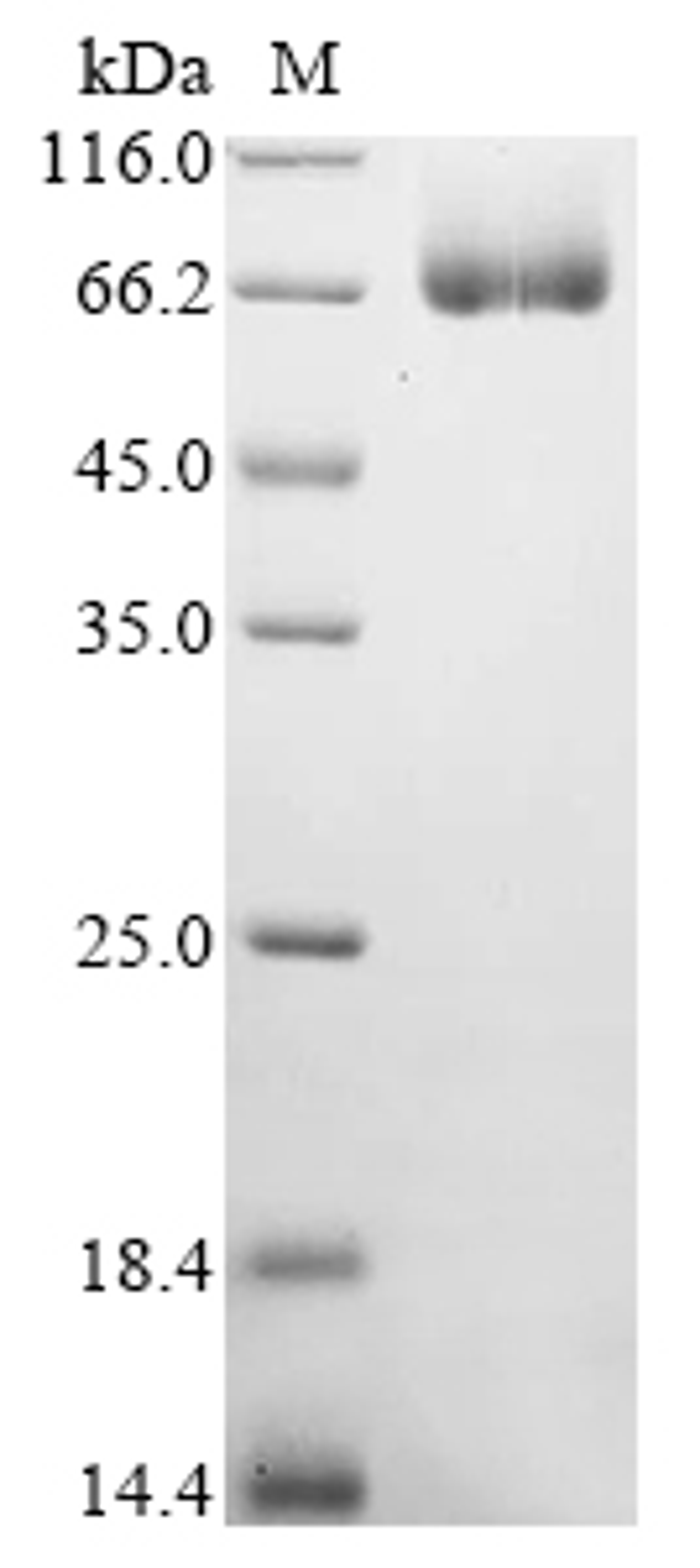 (Tris-Glycine gel) Discontinuous SDS-PAGE (reduced) with 5% enrichment gel and 15% separation gel.