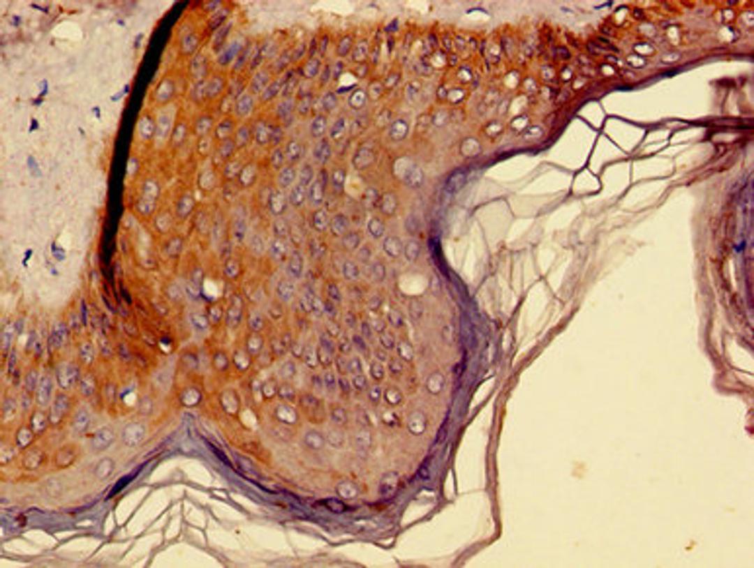Immunohistochemistry of paraffin-embedded human skin tissue using CSB-PA012459LA01HU at dilution of 1:100