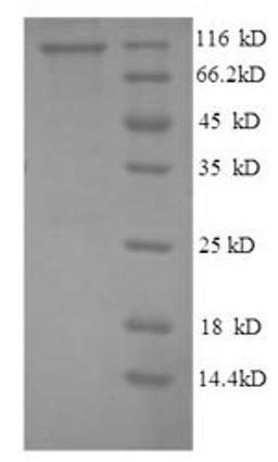 (Tris-Glycine gel) Discontinuous SDS-PAGE (reduced) with 5% enrichment gel and 15% separation gel.