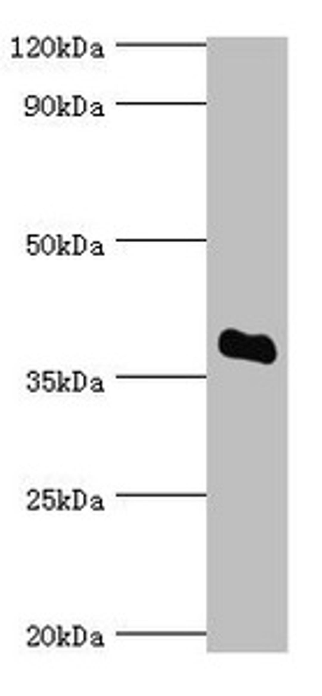 Western blot. All lanes: Bile salt sulfotransferase antibody at 5ug/ml + HepG2 whole cell lysate. Secondary. Goat polyclonal to rabbit IgG at 1/10000 dilution. Predicted band size: 38 kDa. Observed band size: 38 kDa. 