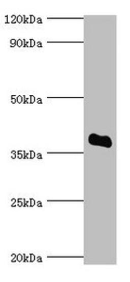 Western blot. All lanes: Bile salt sulfotransferase antibody at 5ug/ml + HepG2 whole cell lysate. Secondary. Goat polyclonal to rabbit IgG at 1/10000 dilution. Predicted band size: 38 kDa. Observed band size: 38 kDa. 