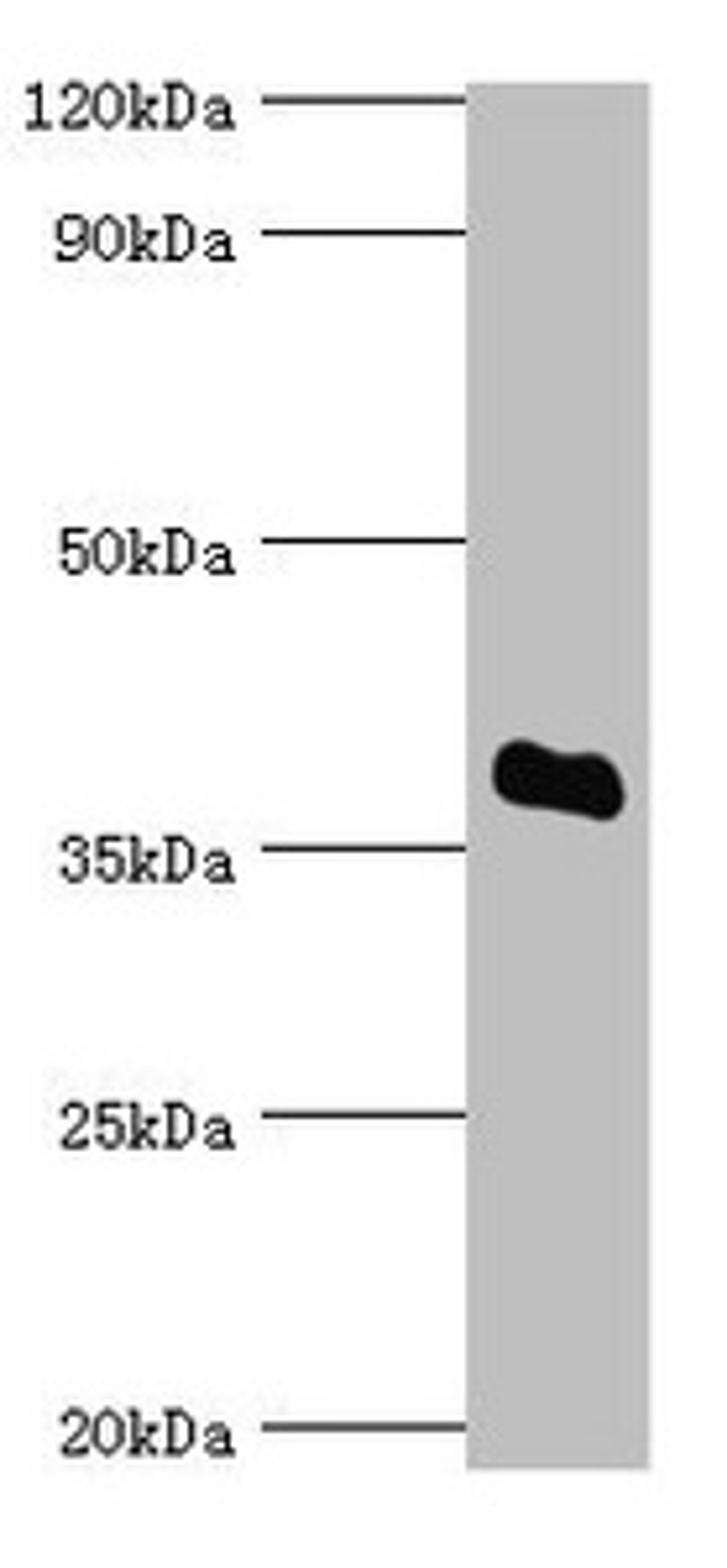 Western blot. All lanes: Bile salt sulfotransferase antibody at 5ug/ml + HepG2 whole cell lysate. Secondary. Goat polyclonal to rabbit IgG at 1/10000 dilution. Predicted band size: 38 kDa. Observed band size: 38 kDa. 