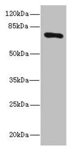 Western blot. All lanes: SLCO2B1 antibody at 1.5µg/ml + HepG2 whole cell lysate. Secondary. Goat polyclonal to rabbit IgG at 1/10000 dilution. Predicted band size: 77, 53, 75, 62 kDa. Observed band size: 77 kDa