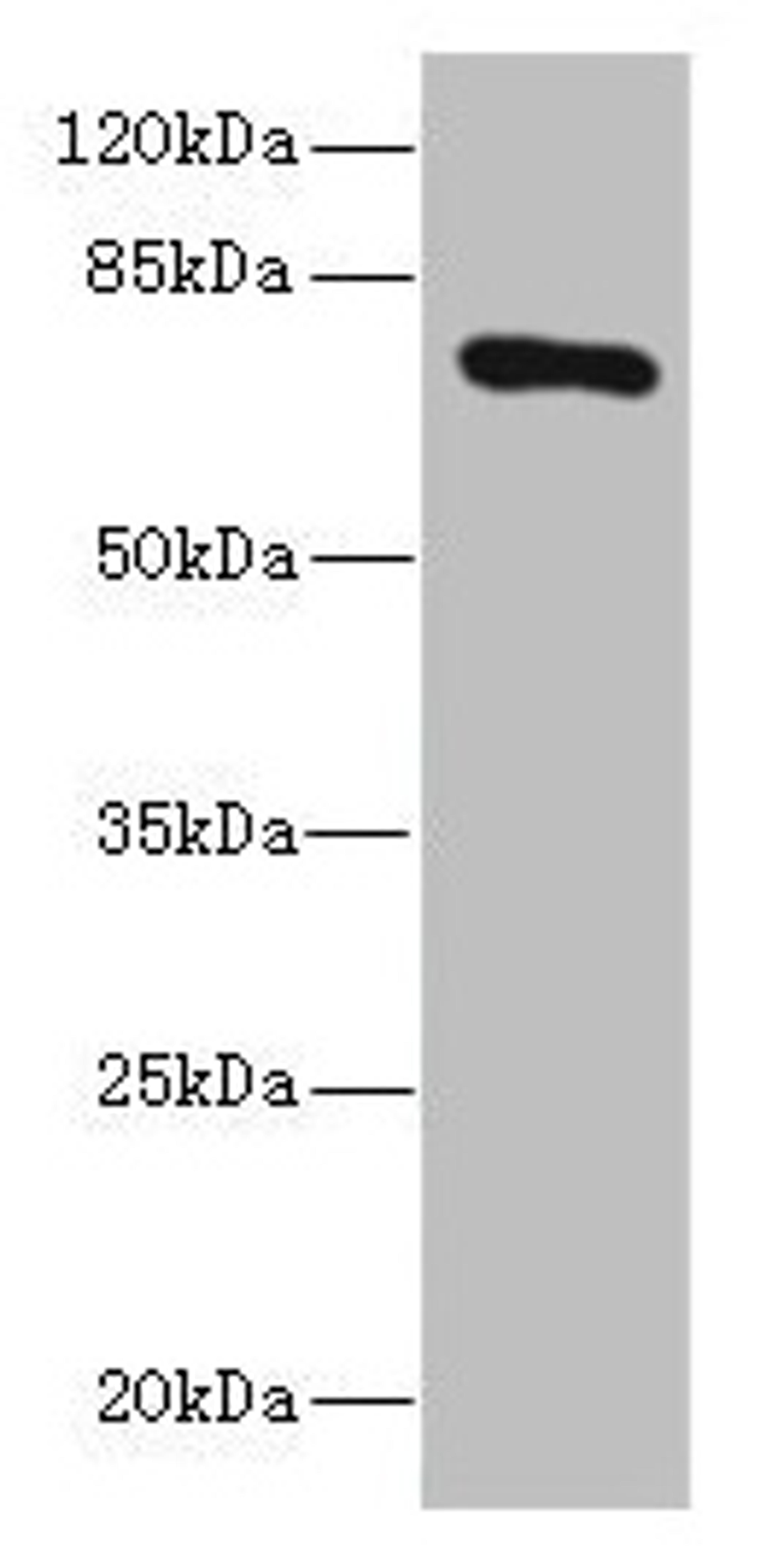 Western blot. All lanes: SLCO2B1 antibody at 1.5µg/ml + HepG2 whole cell lysate. Secondary. Goat polyclonal to rabbit IgG at 1/10000 dilution. Predicted band size: 77, 53, 75, 62 kDa. Observed band size: 77 kDa