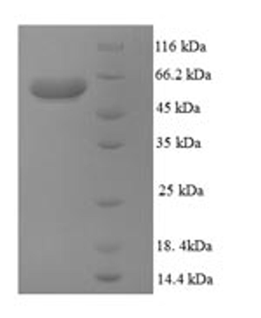 (Tris-Glycine gel) Discontinuous SDS-PAGE (reduced) with 5% enrichment gel and 15% separation gel.