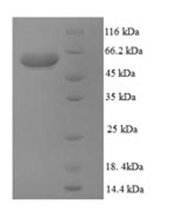 (Tris-Glycine gel) Discontinuous SDS-PAGE (reduced) with 5% enrichment gel and 15% separation gel.