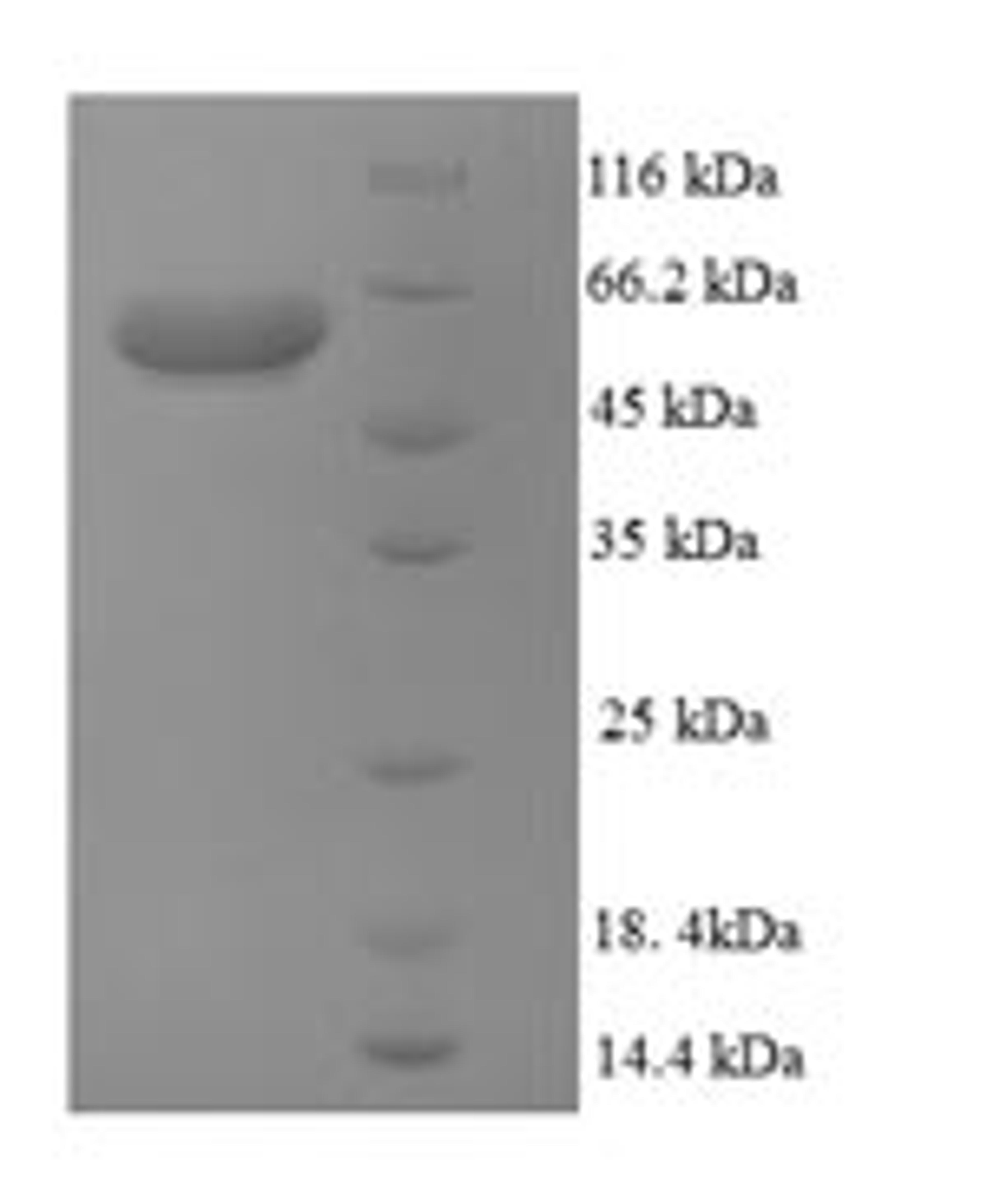 (Tris-Glycine gel) Discontinuous SDS-PAGE (reduced) with 5% enrichment gel and 15% separation gel.