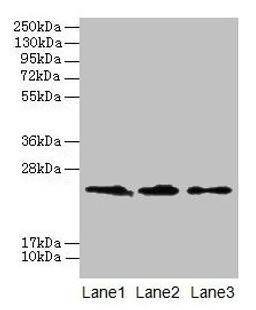 Western blot. All lanes: CLDN20 antibody at 4µg/ml. Lane 1: A549 whole cell lysate. Lane 2: HepG2 whole cell lysate. Lane 3: PC-3 whole cell lysate. Secondary. Goat polyclonal to rabbit IgG at 1/10000 dilution. Predicted band size: 24 kDa. Observed band size: 24 kDa