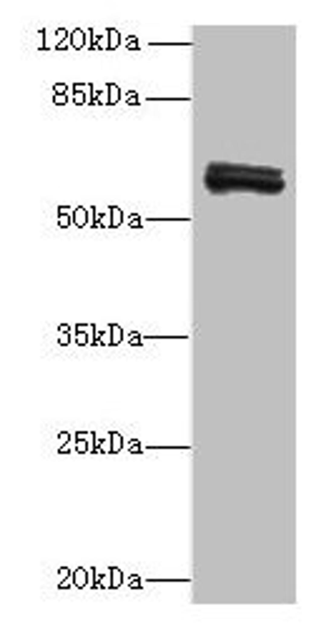 Western blot. All lanes: FAM222B antibody at 2µg/ml + Mouse liver tissue. Secondary. Goat polyclonal to rabbit at 1/10000 dilution. Predicted band size: 60 kDa. Observed band size: 60 kDa