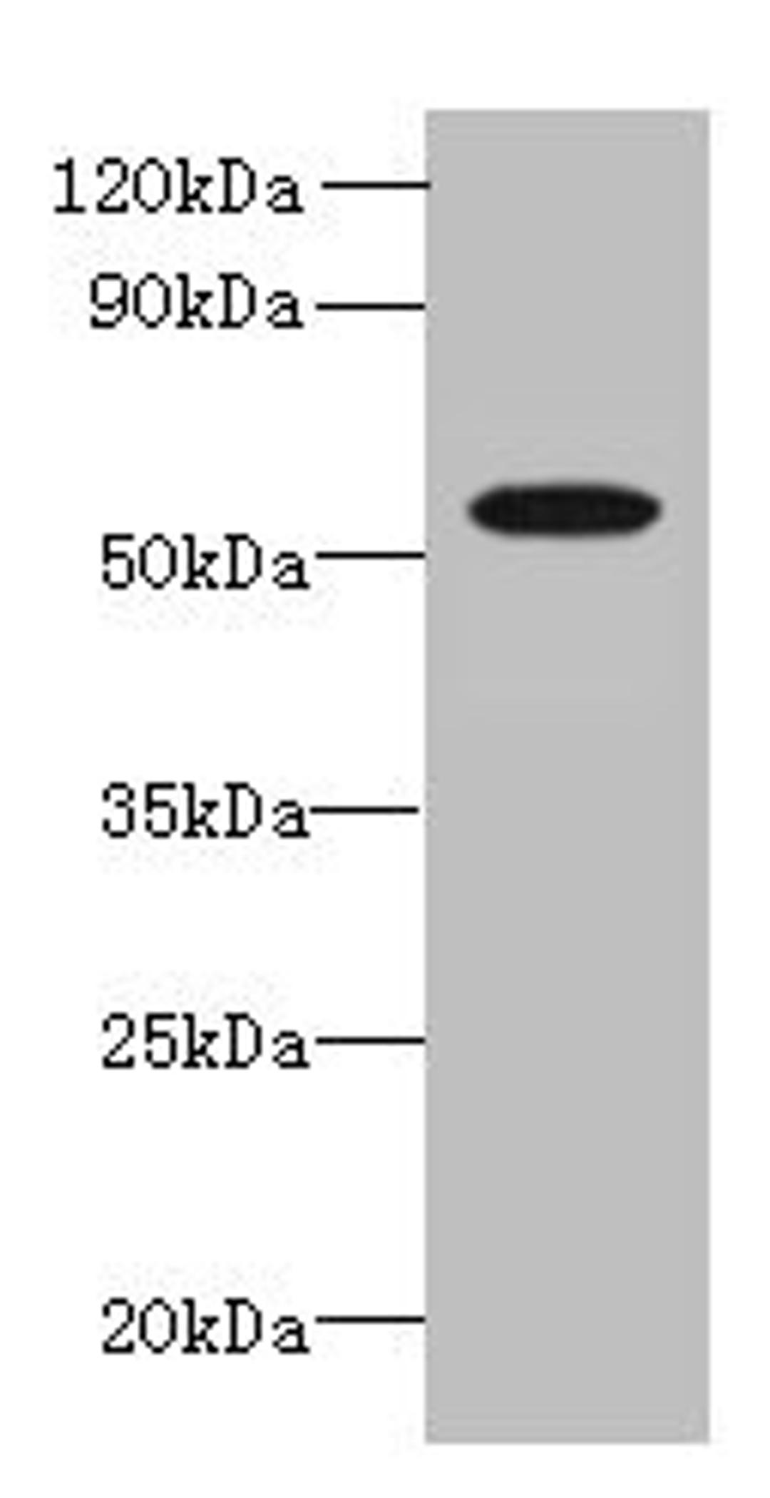 Western blot. All lanes: L2HGDH antibody at 8µg/ml + K562 whole cell lysate. Secondary. Goat polyclonal to rabbit IgG at 1/10000 dilution. Predicted band size: 51, 49 kDa. Observed band size: 51 kDa