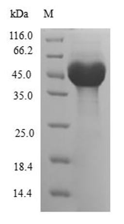 (Tris-Glycine gel) Discontinuous SDS-PAGE (reduced) with 5% enrichment gel and 15% separation gel.