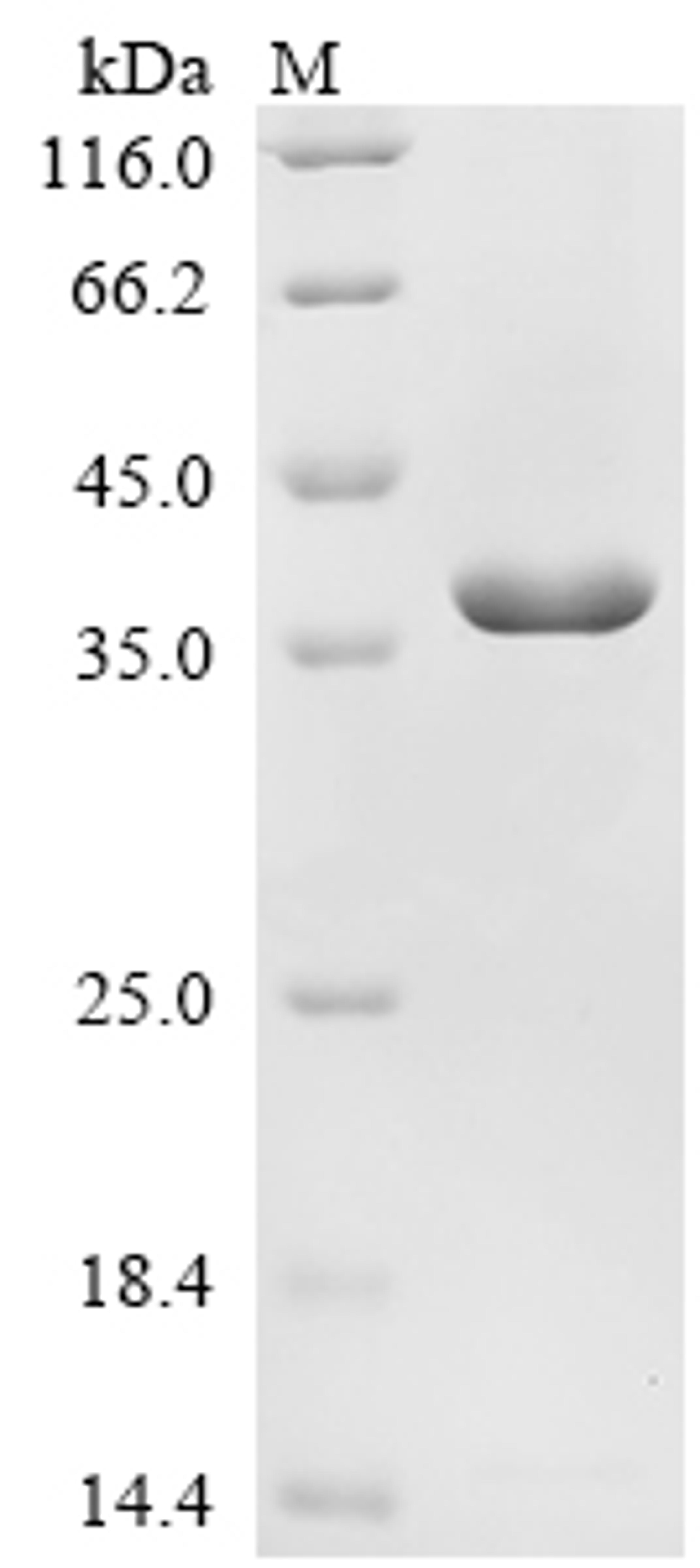 (Tris-Glycine gel) Discontinuous SDS-PAGE (reduced) with 5% enrichment gel and 15% separation gel.