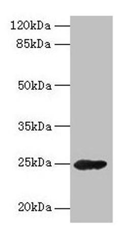 Western blot. All lanes: GH2 antibody at 16µg/ml + Mouse skeletal muscle tissue. Secondary. Goat polyclonal to rabbit IgG at 1/10000 dilution. Predicted band size: 25, 29, 24, 28 kDa. Observed band size: 25 kDa