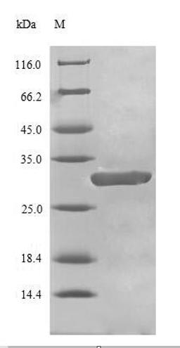 (Tris-Glycine gel) Discontinuous SDS-PAGE (reduced) with 5% enrichment gel and 15% separation gel.