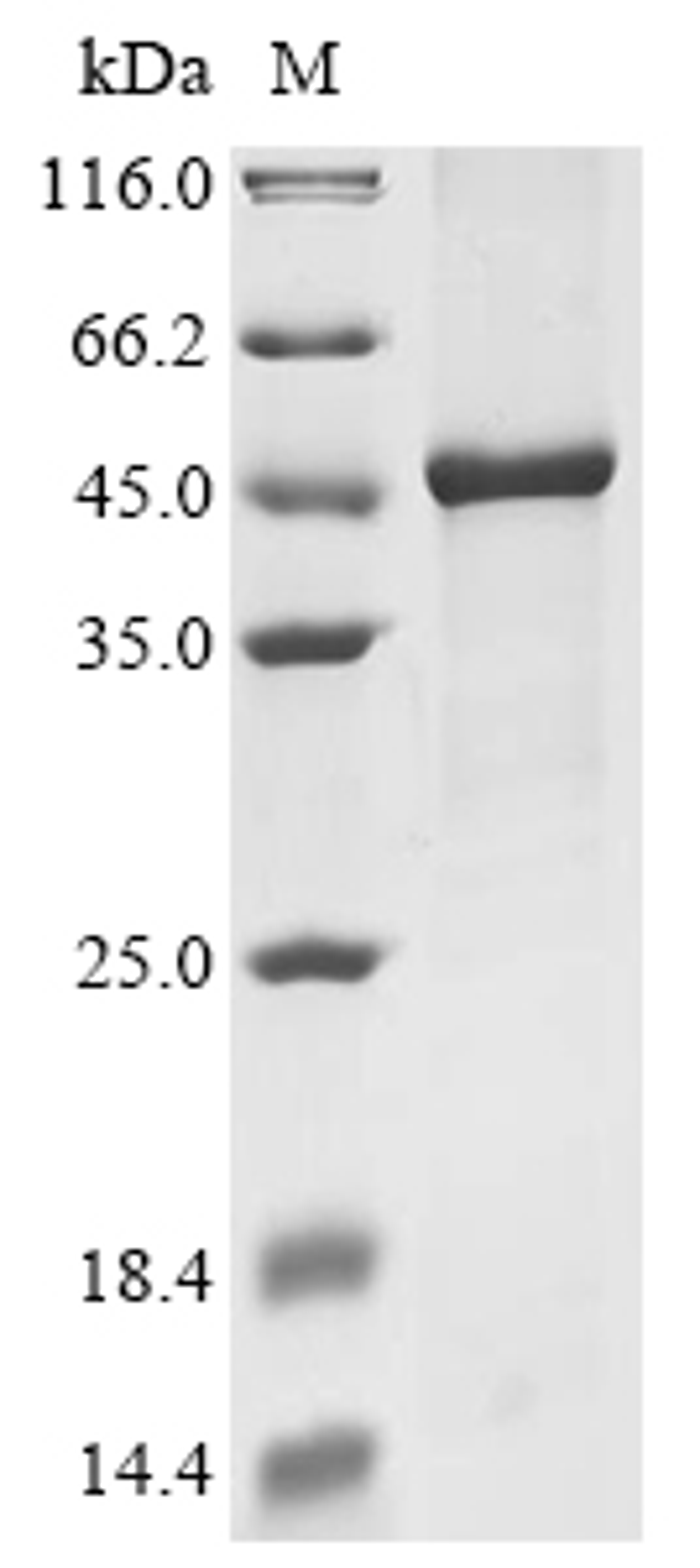 (Tris-Glycine gel) Discontinuous SDS-PAGE (reduced) with 5% enrichment gel and 15% separation gel.