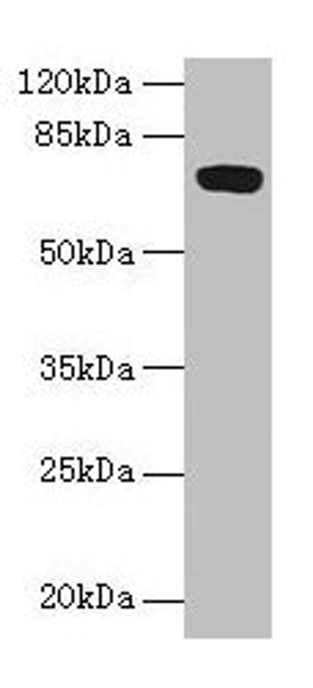 Western blot. All lanes: FAM234B antibody at 6µg/ml + Human placenta tissue. Secondary. Goat polyclonal to rabbit IgG at 1/10000 dilution. Predicted band size: 68 kDa. Observed band size: 68 kDa