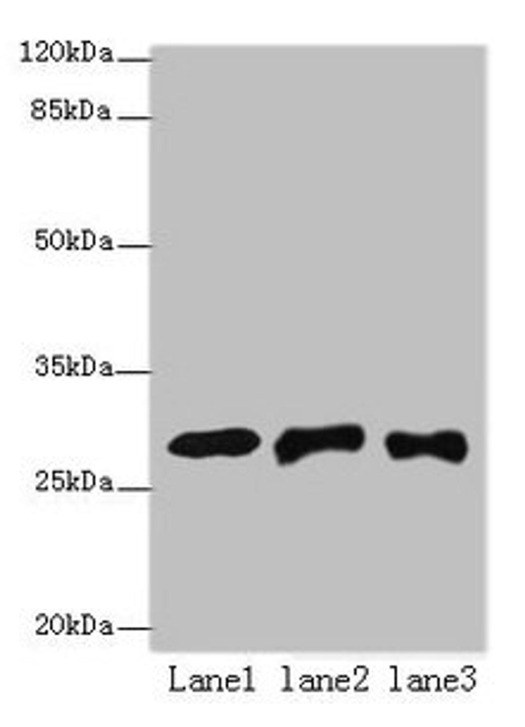 Western blot. All lanes: ETHE1 antibody at 8µg/ml. Lane 1: Mouse liver tissue. Lane 2: HepG2 whole cell lysate. Lane 3: Hela whole cell lysate. Secondary. Goat polyclonal to rabbit IgG at 1/10000 dilution. Predicted band size: 28 kDa. Observed band size: 28 kDa