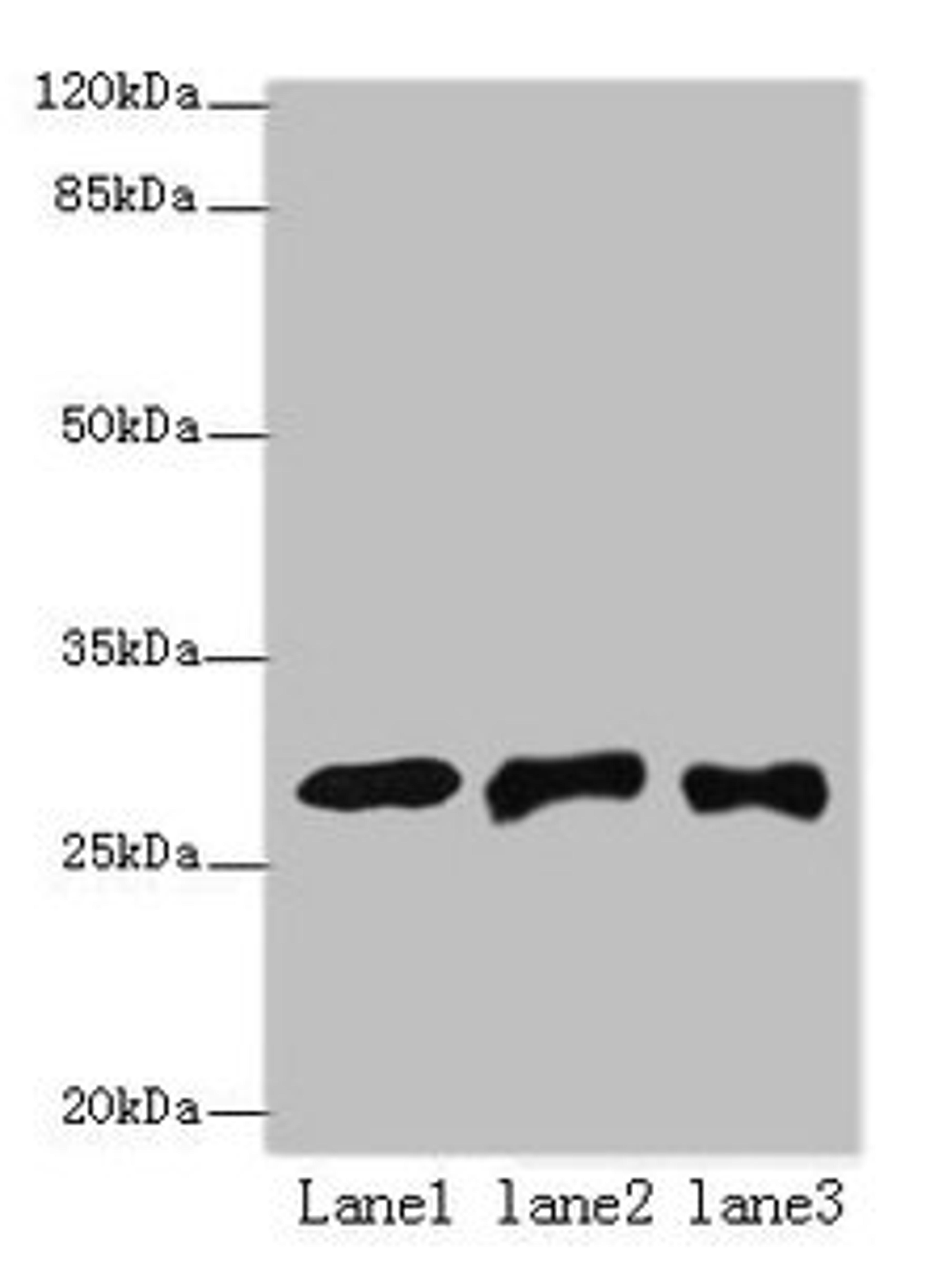 Western blot. All lanes: ETHE1 antibody at 8µg/ml. Lane 1: Mouse liver tissue. Lane 2: HepG2 whole cell lysate. Lane 3: Hela whole cell lysate. Secondary. Goat polyclonal to rabbit IgG at 1/10000 dilution. Predicted band size: 28 kDa. Observed band size: 28 kDa