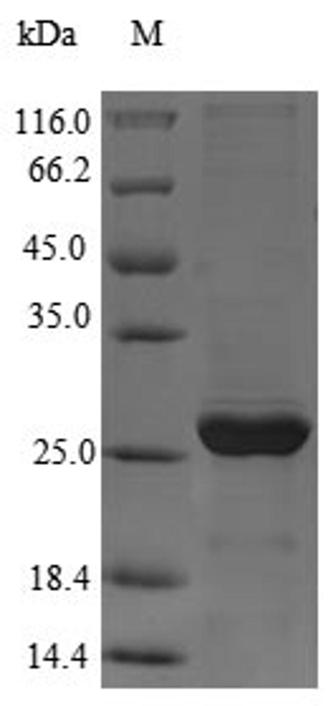 (Tris-Glycine gel) Discontinuous SDS-PAGE (reduced) with 5% enrichment gel and 15% separation gel.