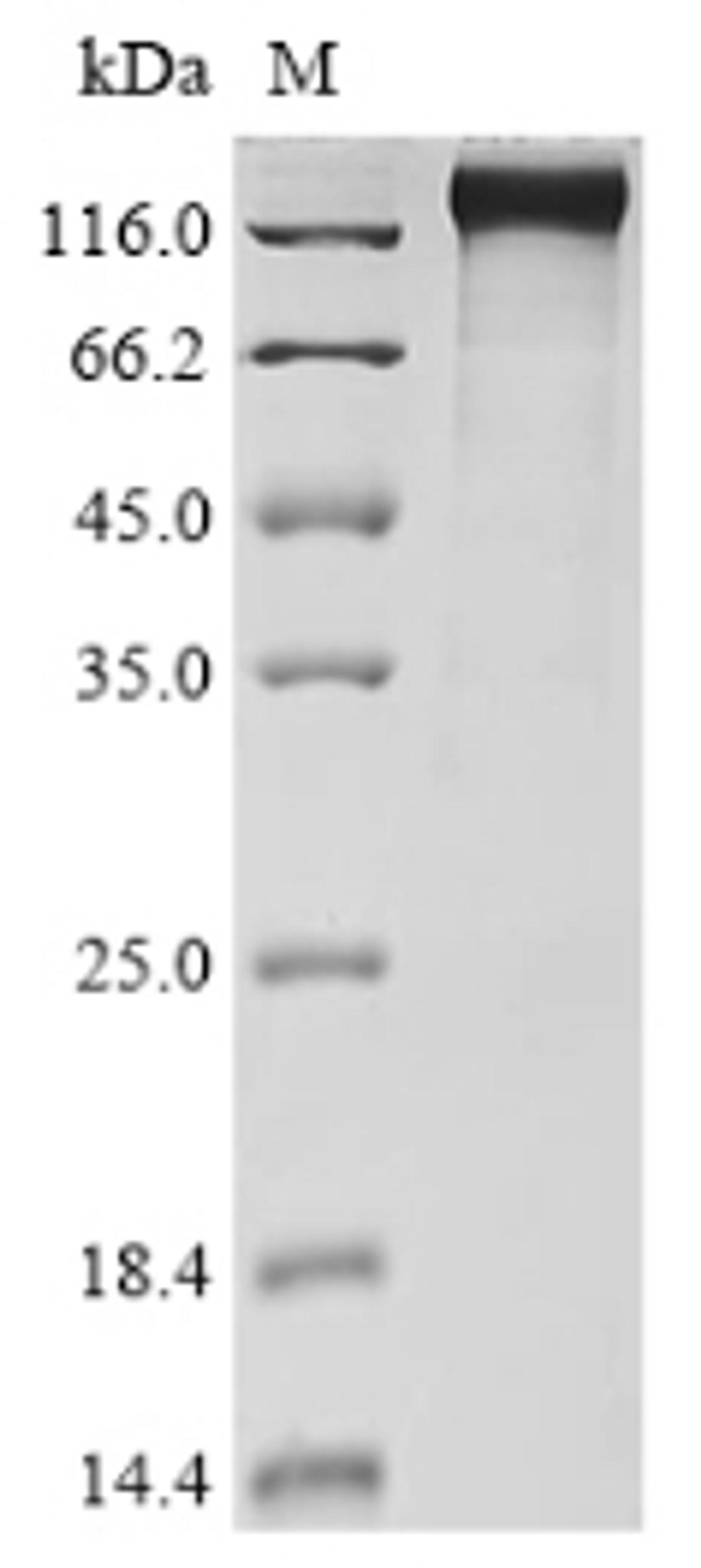 (Tris-Glycine gel) Discontinuous SDS-PAGE (reduced) with 5% enrichment gel and 15% separation gel.