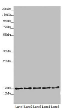 Western blot. All lanes: TIMM17B antibody at 1.75 ug/ml. Lane 1: U251 whole cell lysate. Lane 2: Jurkat whole cell lysate. Lane 3: HepG2 whole cell lysate. Lane 4: HL60 whole cell lysate. Lane 5: A431 whole cell lysate. Secondary. Goat polyclonal to rabbit IgG at 1/10000 dilution. Predicted band size: 19, 24 kDa. Observed band size: 19 kDa. 