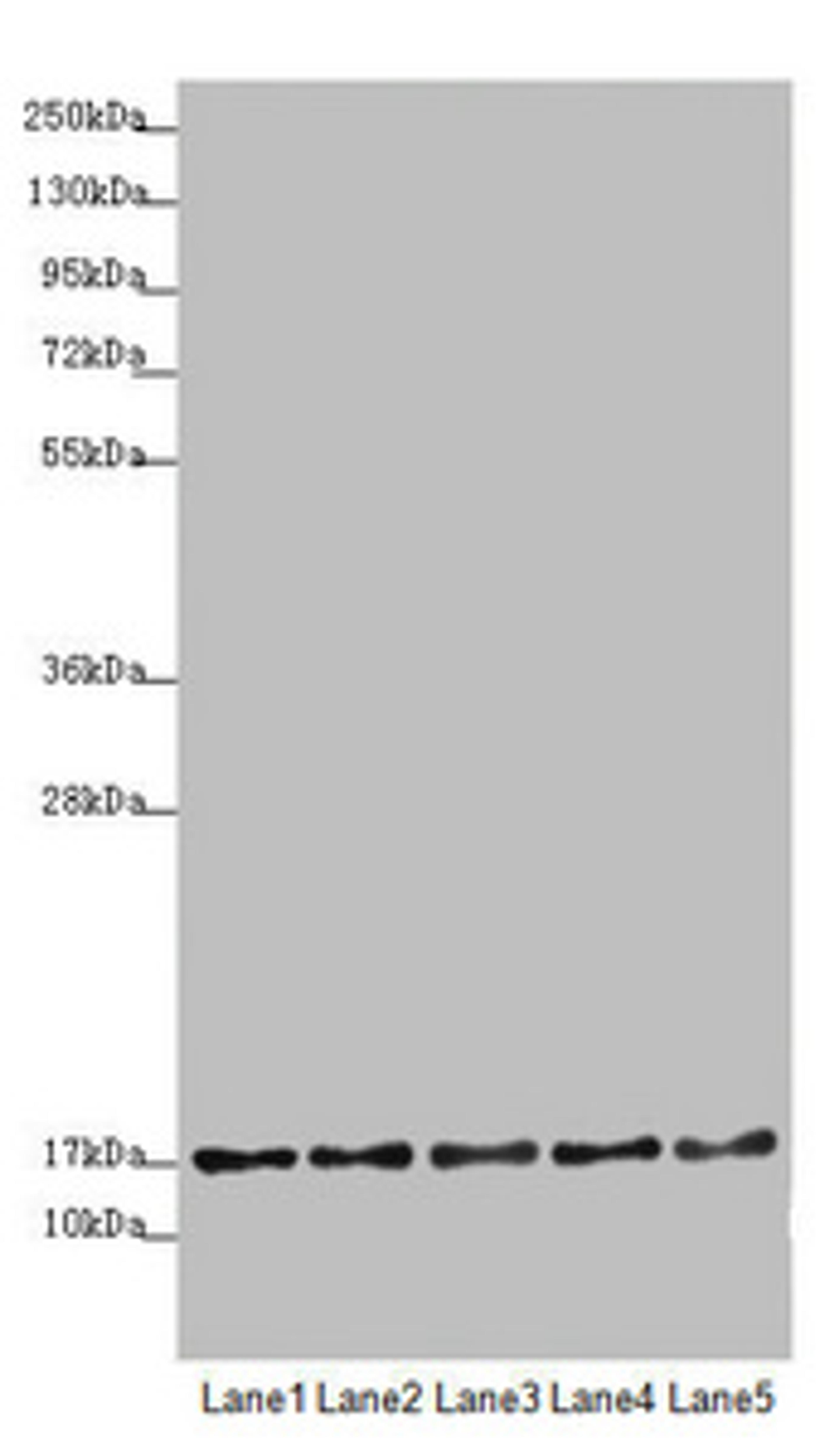 Western blot. All lanes: TIMM17B antibody at 1.75 ug/ml. Lane 1: U251 whole cell lysate. Lane 2: Jurkat whole cell lysate. Lane 3: HepG2 whole cell lysate. Lane 4: HL60 whole cell lysate. Lane 5: A431 whole cell lysate. Secondary. Goat polyclonal to rabbit IgG at 1/10000 dilution. Predicted band size: 19, 24 kDa. Observed band size: 19 kDa. 