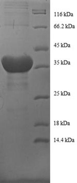(Tris-Glycine gel) Discontinuous SDS-PAGE (reduced) with 5% enrichment gel and 15% separation gel.