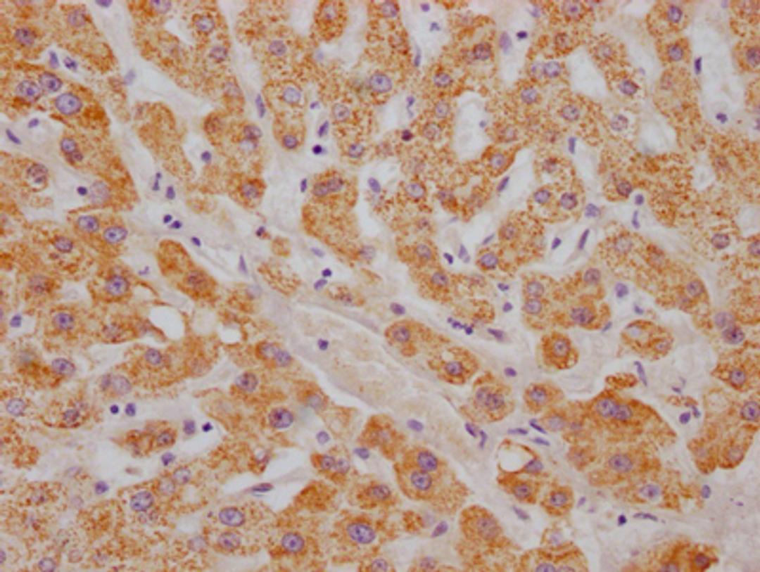 IHC image of CSB-RA242969A0HU diluted at 1:100 and staining in paraffin-embedded human liver tissue performed on a Leica BondTM system. After dewaxing and hydration, antigen retrieval was mediated by high pressure in a citrate buffer (pH 6.0). Section was blocked with 10% normal goat serum 30min at RT. Then primary antibody (1% BSA) was incubated at 4℃ overnight. The primary is detected by a Goat anti-rabbit IgG polymer labeled by HRP and visualized using 0.05% DAB.