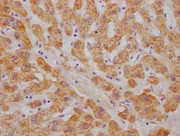 IHC image of CSB-RA242969A0HU diluted at 1:100 and staining in paraffin-embedded human liver tissue performed on a Leica BondTM system. After dewaxing and hydration, antigen retrieval was mediated by high pressure in a citrate buffer (pH 6.0). Section was blocked with 10% normal goat serum 30min at RT. Then primary antibody (1% BSA) was incubated at 4℃ overnight. The primary is detected by a Goat anti-rabbit IgG polymer labeled by HRP and visualized using 0.05% DAB.