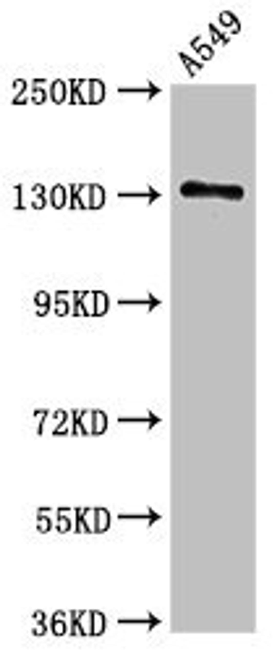 Western Blot. Positive WB detected in: A549 whole cell lysate. All lanes: EGFR antibody at 2.5ug/ml. Secondary. Goat polyclonal to rabbit IgG at 1/50000 dilution. Predicted band size: 135, 45, 78, 70 kDa. Observed band size: 135 kDa. 