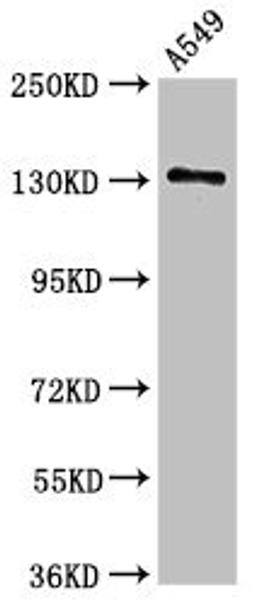Western Blot. Positive WB detected in: A549 whole cell lysate. All lanes: EGFR antibody at 2.5ug/ml. Secondary. Goat polyclonal to rabbit IgG at 1/50000 dilution. Predicted band size: 135, 45, 78, 70 kDa. Observed band size: 135 kDa. 