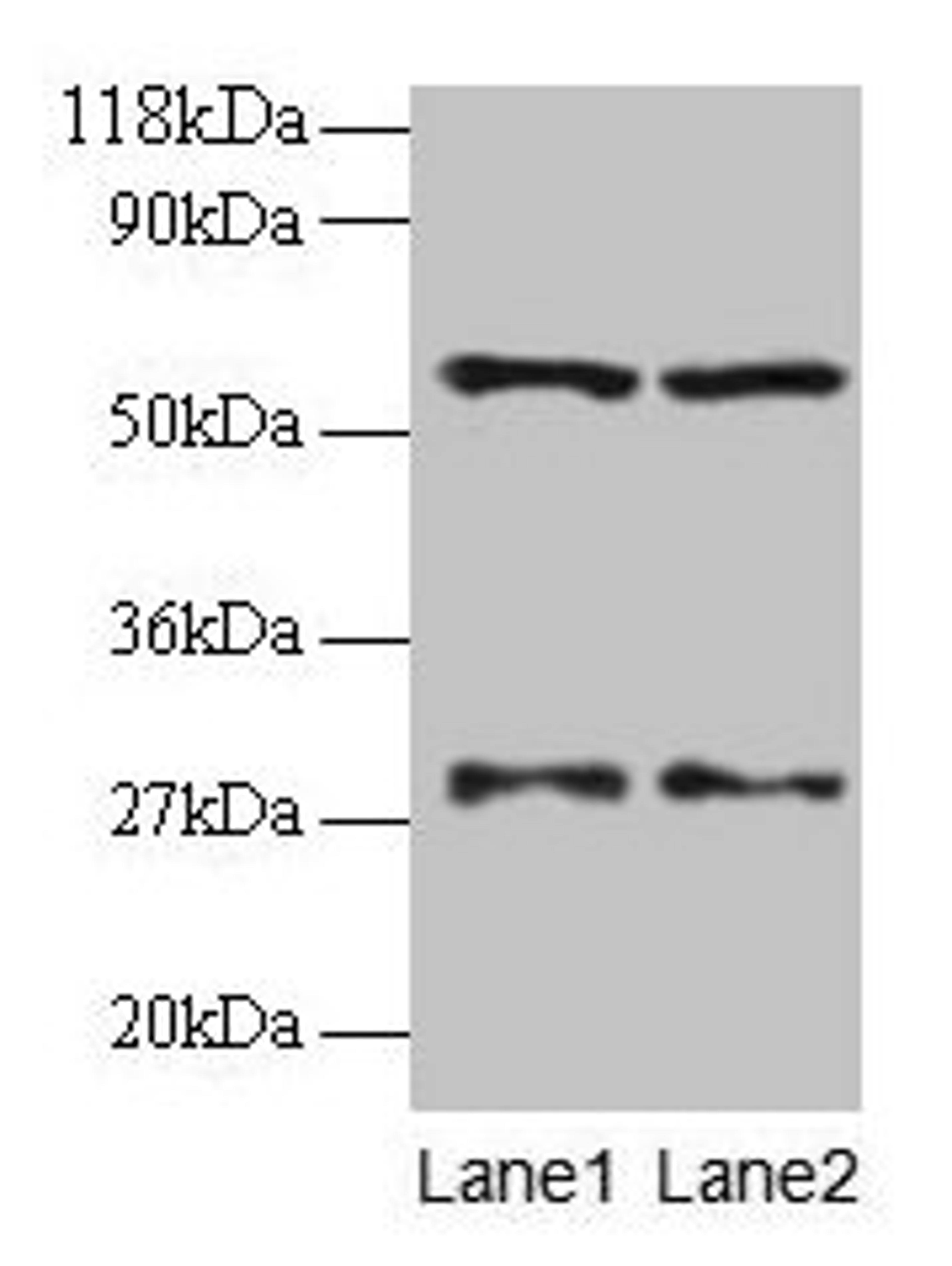 Western blot. All lanes: SARS antibody at 2µg/ml. Lane 1: EC109 whole cell lysate. Lane 2: 293T whole cell lysate. Secondary. Goat polyclonal to rabbit IgG at 1/15000 dilution. Predicted band size: 59 kDa. Observed band size: 59 kDa