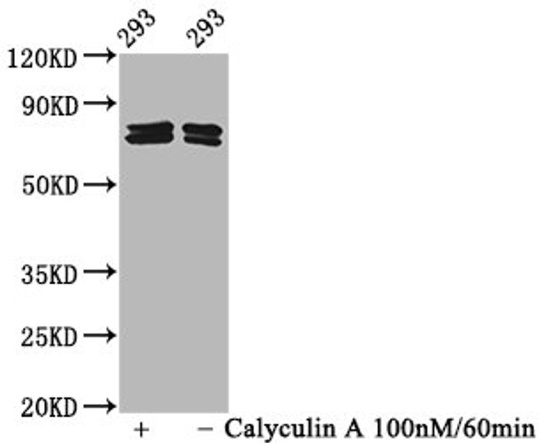 Western Blot. Positive WB detected in 293 whole cell lysate(treated with Calyculin A or not). All lanes Phospho-PAK4/PAK5/PAK6 antibody at 2.15μg/ml. Secondary. Goat polyclonal to rabbit IgG at 1/50000 dilution. Predicted band size: 64,75,80 KDa. Observed band size: 75,80 KDa. 