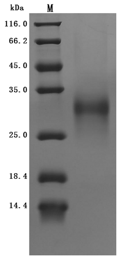 (Tris-Glycine gel) Discontinuous SDS-PAGE (reduced) with 5% enrichment gel and 15% separation gel.