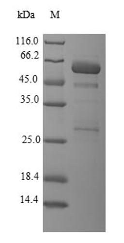 (Tris-Glycine gel) Discontinuous SDS-PAGE (reduced) with 5% enrichment gel and 15% separation gel.