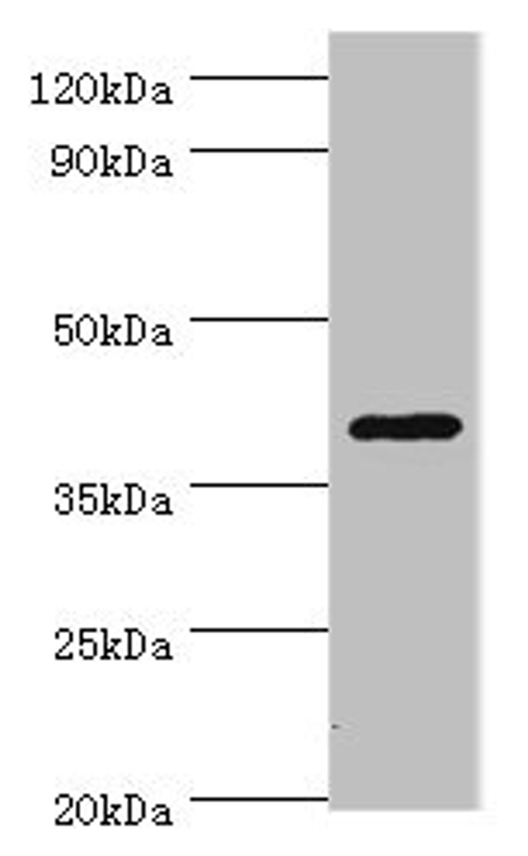 Western blot. All lanes: HDAC11 antibody at 2ug/ml + Mouse brain tissue. Secondary. Goat polyclonal to rabbit IgG at 1/10000 dilution. Predicted band size: 40, 34 kDa. Observed band size: 40 kDa. 