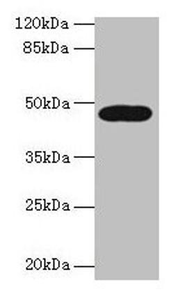 Western blot. All lanes: LIPA antibody at 10µg/ml + A431 whole cell lysate. Secondary. Goat polyclonal to rabbit IgG at 1/10000 dilution. Predicted band size: 46, 40 kDa. Observed band size: 46 kDa