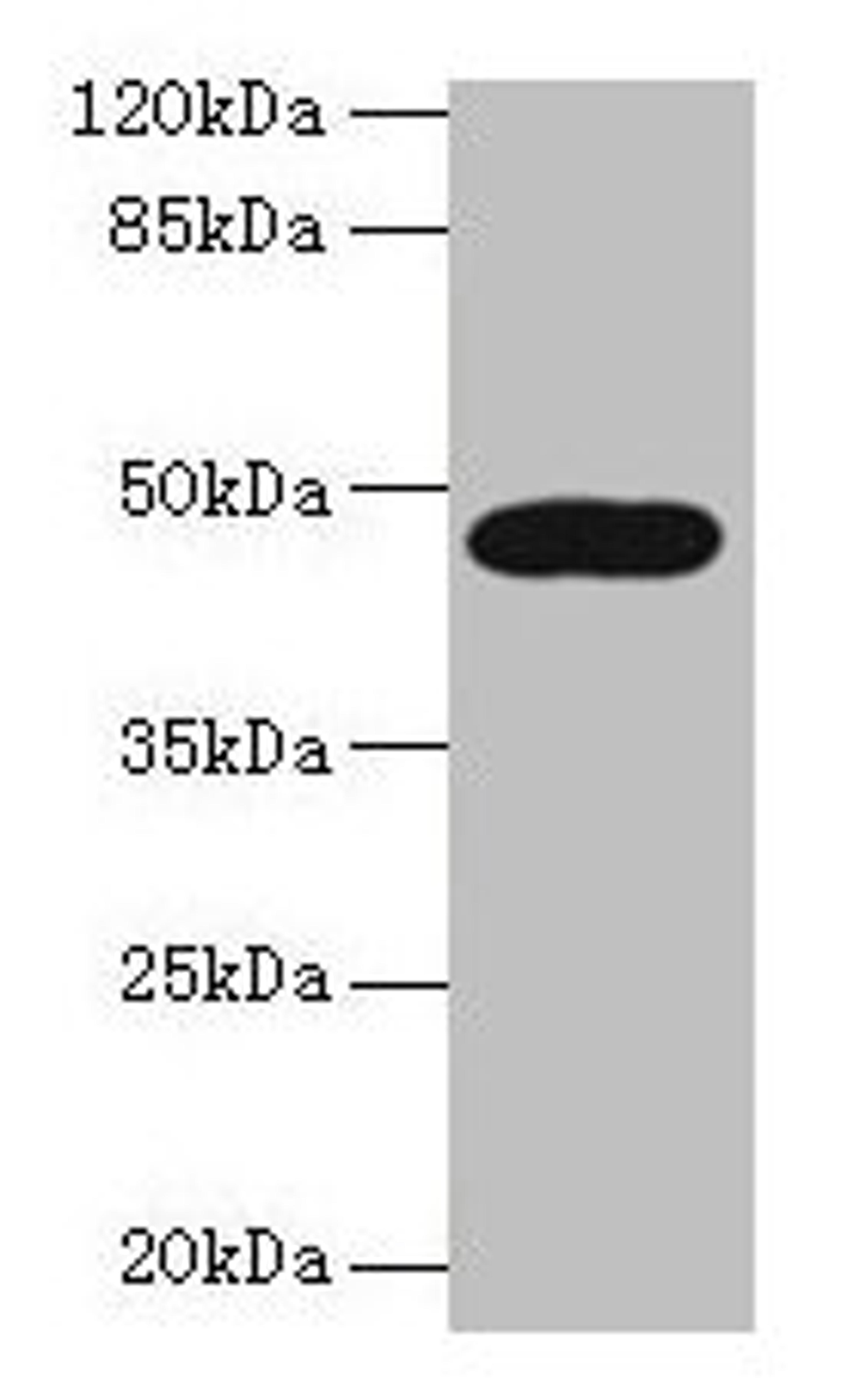 Western blot. All lanes: LIPA antibody at 10µg/ml + A431 whole cell lysate. Secondary. Goat polyclonal to rabbit IgG at 1/10000 dilution. Predicted band size: 46, 40 kDa. Observed band size: 46 kDa