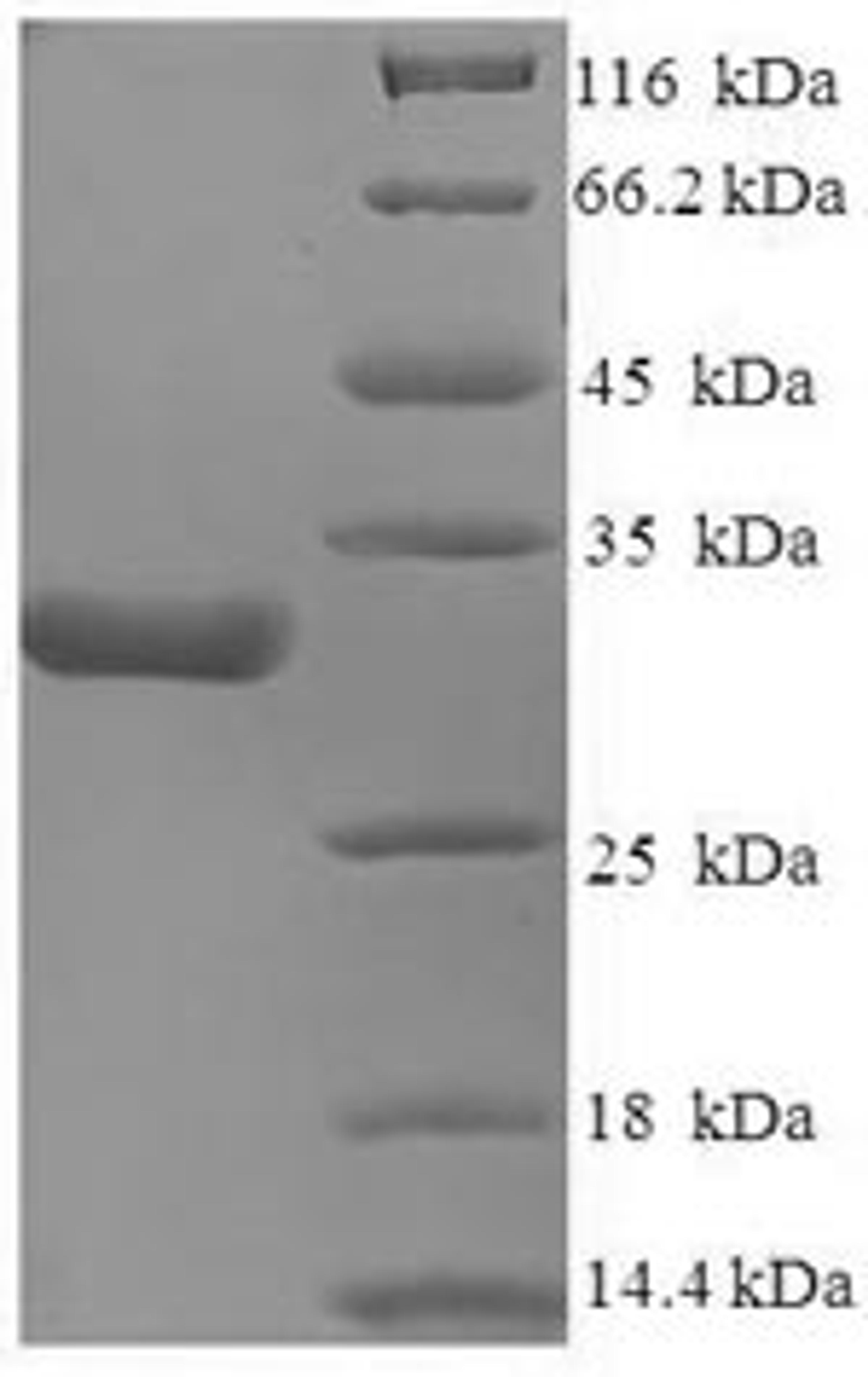 (Tris-Glycine gel) Discontinuous SDS-PAGE (reduced) with 5% enrichment gel and 15% separation gel.