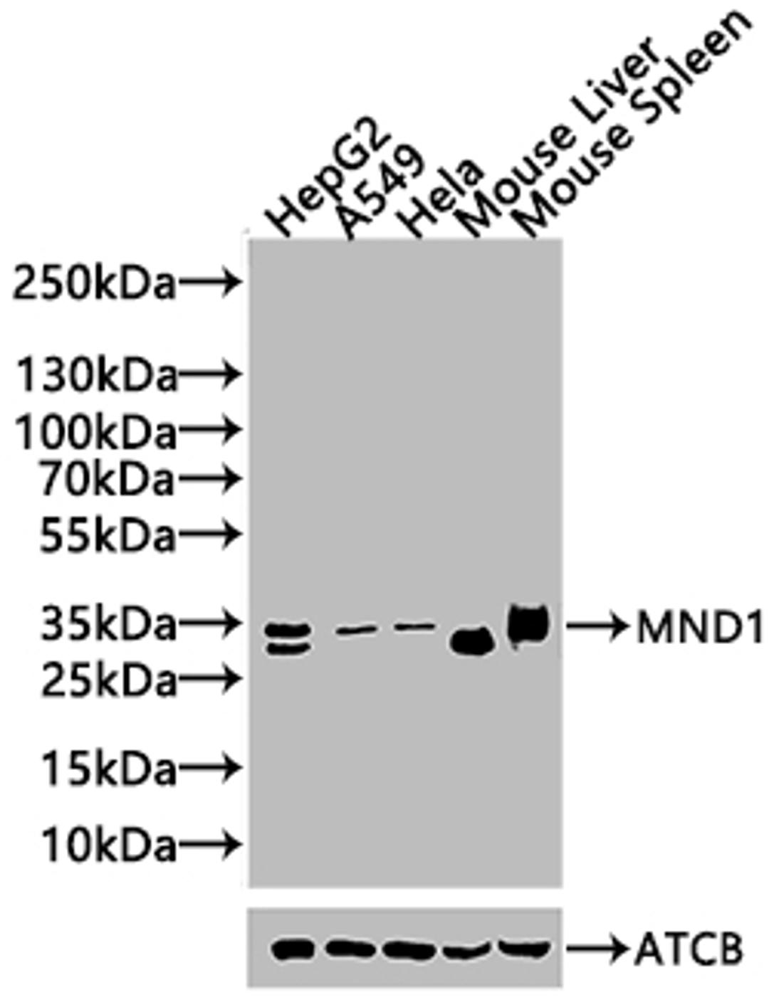 Western blot. All lanes: MND1 antibody at 10ug/ml + Jurkat whole cell lysate. Secondary. Goat polyclonal to rabbit IgG at 1/10000 dilution. Predicted band size: 24 kDa. Observed band size: 24 kDa. 